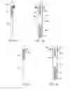Fig. 14 - Soft tissue measurement and balancing systems and methods