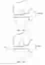 Fig. 28 - Soft tissue measurement and balancing systems and methods