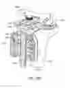 Fig. 43 - Soft tissue measurement and balancing systems and methods