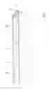 Fig. 02 - ASPIRATION CATHETER