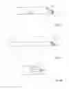 Fig. 04 - ASPIRATION CATHETER