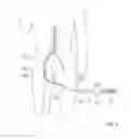 Fig. 08 - ASPIRATION CATHETER