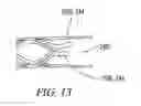 Fig. 10 - Clot retrieval system
