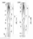 Fig. 121 - Clot retrieval system