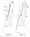Fig. 126 - Clot retrieval system