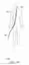 Fig. 128 - Clot retrieval system