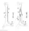 Fig. 47 - Clot retrieval system