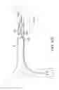 Fig. 61 - Clot retrieval system