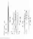 Fig. 70 - Clot retrieval system