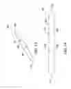 Fig. 79 - Clot retrieval system