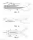 Fig. 88 - Clot retrieval system