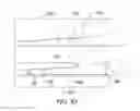 Fig. 95 - Clot retrieval system