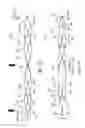 Fig. 96 - Clot retrieval system