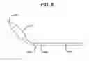Fig. 07 - Methods and apparatus for treating disorders of the sinuses