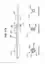 Fig. 18 - Methods and apparatus for treating disorders of the sinuses