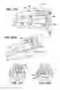 Fig. 25 - Methods and apparatus for treating disorders of the sinuses