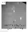 Fig. 19 - Methods, compositions, and systems for device implantation