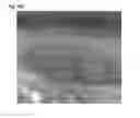Fig. 22 - Methods, compositions, and systems for device implantation
