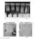 Fig. 04 - Device and method for treating osteonecrosis