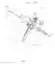 Fig. 11 - Device and method for treating osteonecrosis