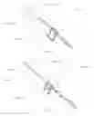 Fig. 22 - Device and method for treating osteonecrosis
