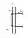 Fig. 01 - Spinous Process Spacer Hammock