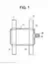 Fig. 02 - Spinous Process Spacer Hammock