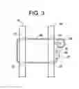 Fig. 05 - Spinous Process Spacer Hammock