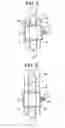 Fig. 07 - Spinous Process Spacer Hammock