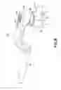 Fig. 09 - Apparatus and method for percutaneously extending an existing spinal construct