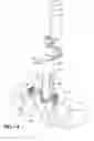 Fig. 16 - Apparatus and method for percutaneously extending an existing spinal construct