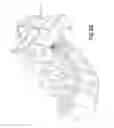 Fig. 30 - Apparatus and method for percutaneously extending an existing spinal construct