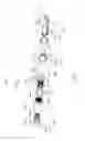Fig. 05 - Adjustable devices for treating arthritis of the knee