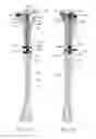 Fig. 10 - Adjustable devices for treating arthritis of the knee