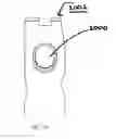 Fig. 26 - Adjustable devices for treating arthritis of the knee