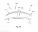 Fig. 14 - Bone plate system and method