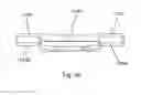 Fig. 37 - Bone plate system and method