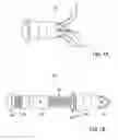 Fig. 02 - Bone implants for the treatment of infection