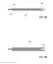 Fig. 04 - Bone implants for the treatment of infection