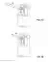 Fig. 07 - Bone implants for the treatment of infection