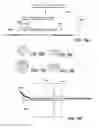 Fig. 18 - Bone implants for the treatment of infection