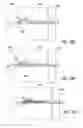 Fig. 19 - Bone implants for the treatment of infection