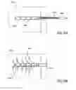 Fig. 21 - Bone implants for the treatment of infection