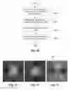 Fig. 09 - Systems and methods for determining orientation of an implanted electrical stimulation lead