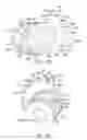 Fig. 17 - Tip ejection assembly for an oral irrigator