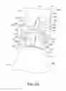 Fig. 26 - Oral care implement body and replacement head therefor