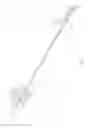 Fig. 06 - Axial lengthening thrombus capture system