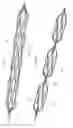 Fig. 71 - Axial lengthening thrombus capture system