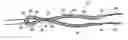 Fig. 01 - Joint stabilisation