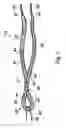 Fig. 06 - Joint stabilisation